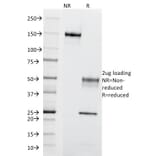 SDS-PAGE - Anti-CD195 Antibody [12D1] (A248230) - Antibodies.com