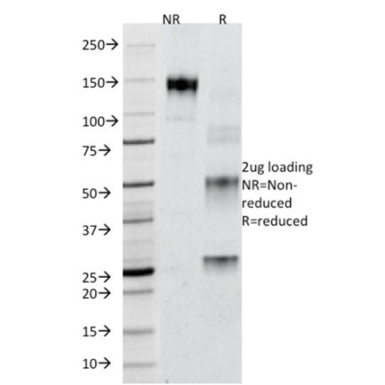 SDS-PAGE - Anti-Adipophilin Antibody [ADFP/1365] (A248231) - Antibodies.com