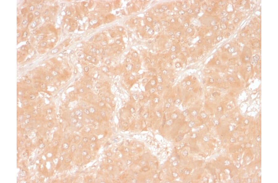 Immunohistochemistry - Anti-Adipophilin Antibody [ADFP/1366] (A248232) - Antibodies.com