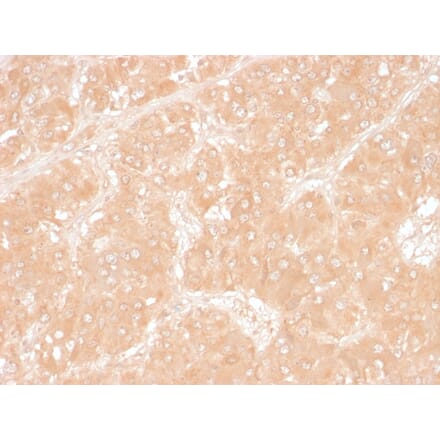 Immunohistochemistry - Anti-Adipophilin Antibody [ADFP/1366] (A248232) - Antibodies.com