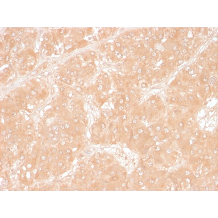 Immunohistochemistry - Anti-Adipophilin Antibody [ADFP/1366] (A248232) - Antibodies.com