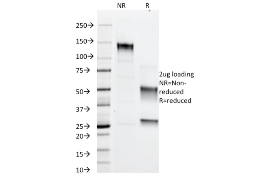 SDS-PAGE - Anti-Adipophilin Antibody [ADFP/1366] (A248232) - Antibodies.com