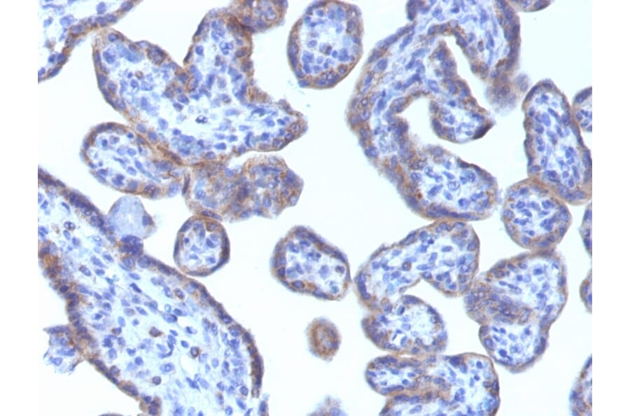 Immunohistochemistry - Anti-Adipophilin Antibody [ADFP/1493] (A248232) - Antibodies.com