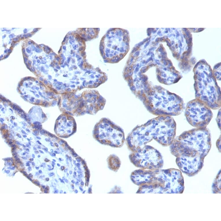 Immunohistochemistry - Anti-Adipophilin Antibody [ADFP/1493] (A248232) - Antibodies.com