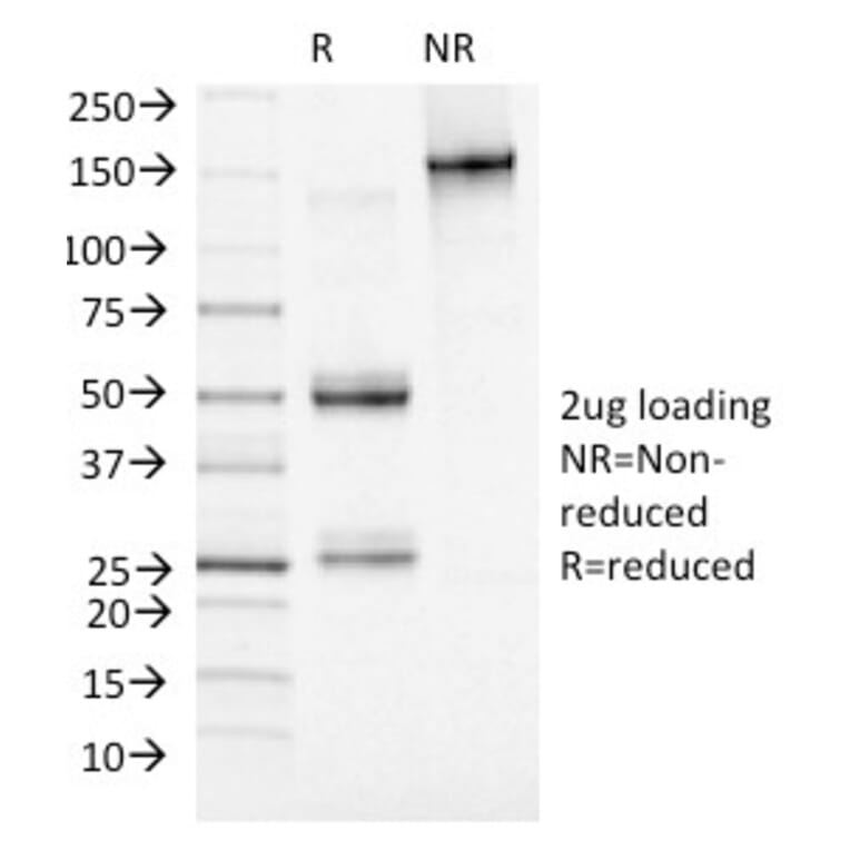 SDS-PAGE - Anti-Adipophilin Antibody [ADFP/1493] (A248233) - Antibodies.com