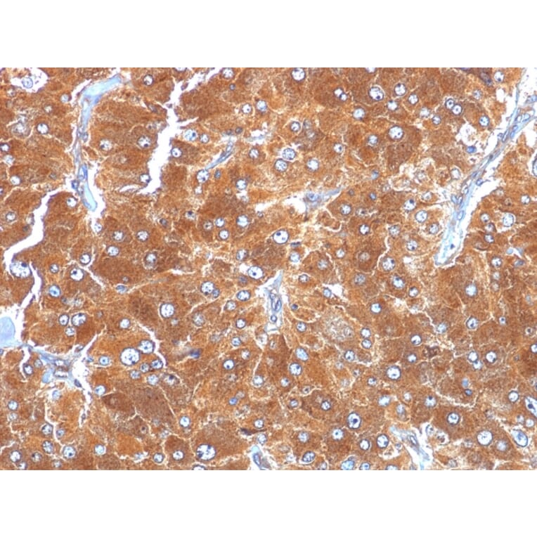 Immunohistochemistry - Anti-Adipophilin Antibody [ADFP/1494] (A248233) - Antibodies.com