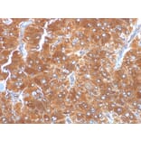 Immunohistochemistry - Anti-Adipophilin Antibody [ADFP/1494] (A248233) - Antibodies.com