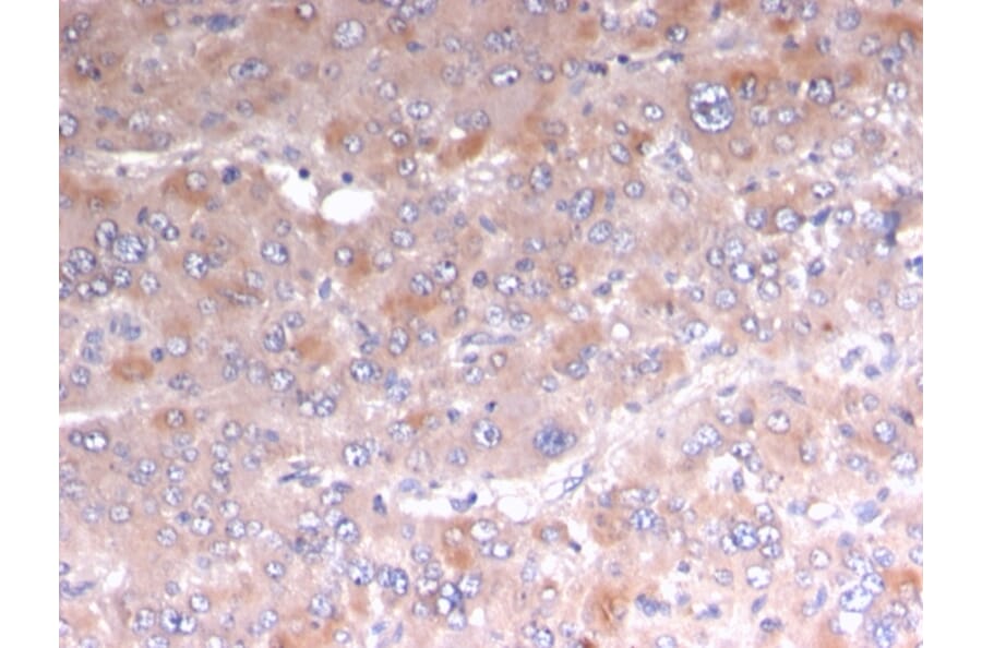 Immunohistochemistry - Anti-Adipophilin Antibody [rADFP/1493] (A248234) - Antibodies.com