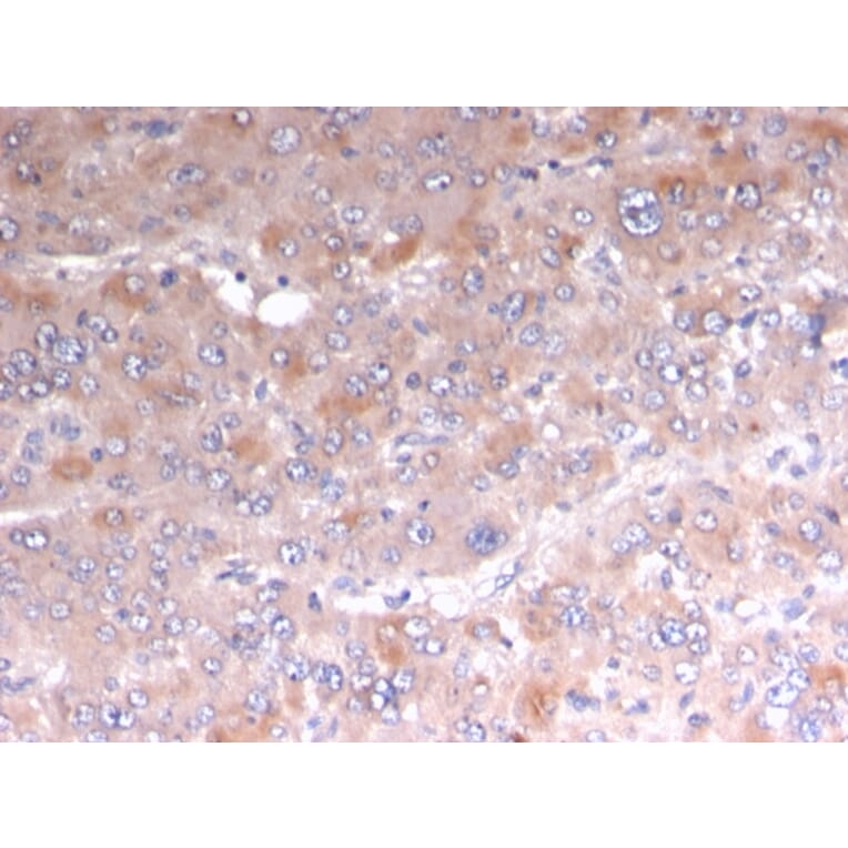 Immunohistochemistry - Anti-Adipophilin Antibody [rADFP/1493] (A248234) - Antibodies.com