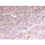 Immunohistochemistry - Anti-Adipophilin Antibody [rADFP/1493] (A248234) - Antibodies.com