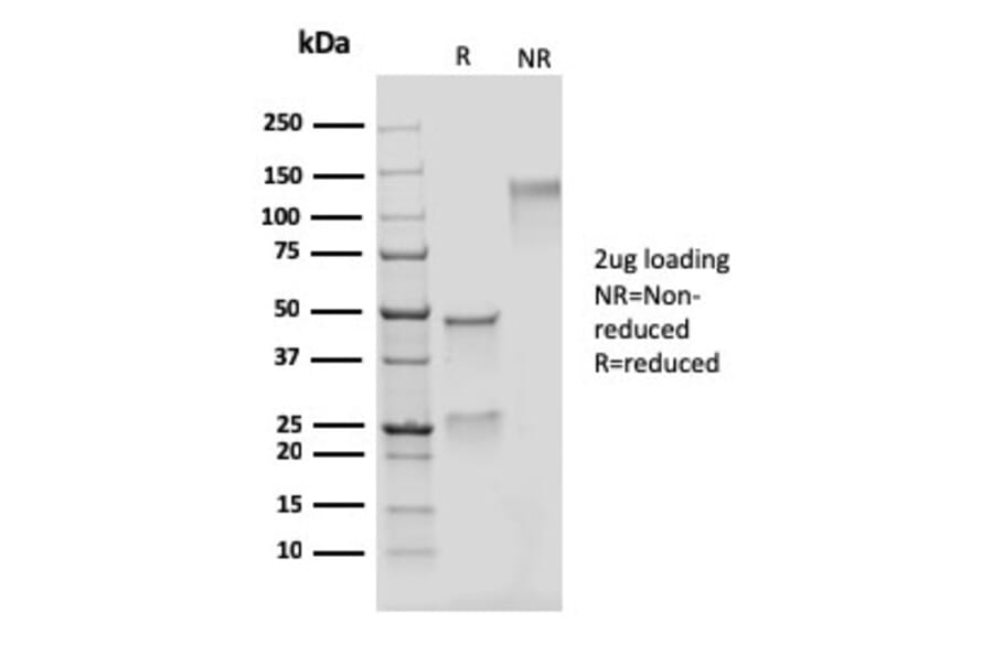 SDS-PAGE - Anti-Adipophilin Antibody [rADFP/1493] (A248235) - Antibodies.com