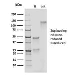 SDS-PAGE - Anti-Adipophilin Antibody [rADFP/1493] (A248235) - Antibodies.com