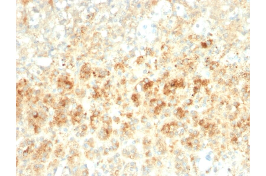 Immunohistochemistry - Anti-Adipophilin Antibody [ADFP/2755R] (A248235) - Antibodies.com