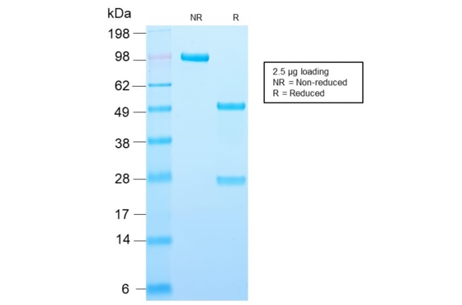 SDS-PAGE - Anti-Adipophilin Antibody [ADFP/2755R] (A248236) - Antibodies.com
