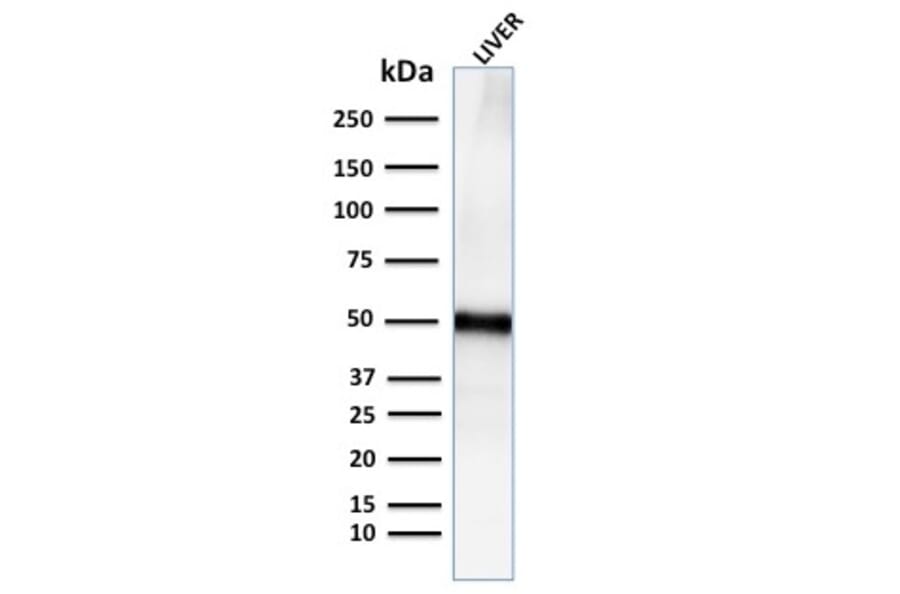 Western Blot - Anti-Adipophilin Antibody [ADFP/2755R] (A248236) - Antibodies.com