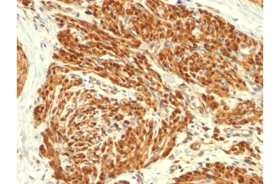 Immunohistochemistry - Anti-Calponin 1 Antibody [CALP] (A248237) - Antibodies.com