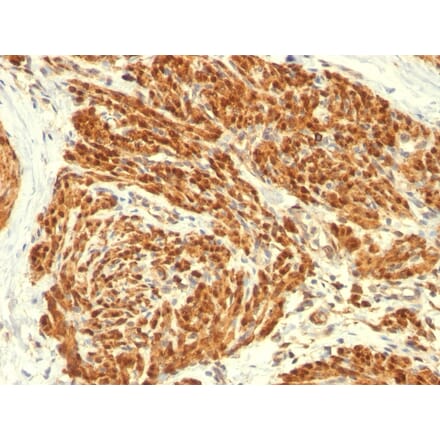 Immunohistochemistry - Anti-Calponin 1 Antibody [CALP] (A248237) - Antibodies.com