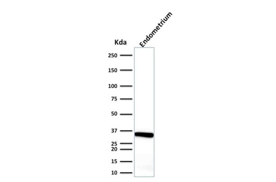 Western Blot - Anti-Calponin 1 Antibody [CALP] (A248237) - Antibodies.com
