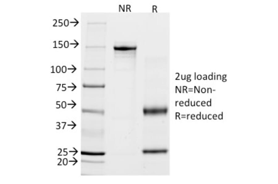 SDS-PAGE - Anti-Calponin 1 Antibody [CALP] (A248237) - Antibodies.com