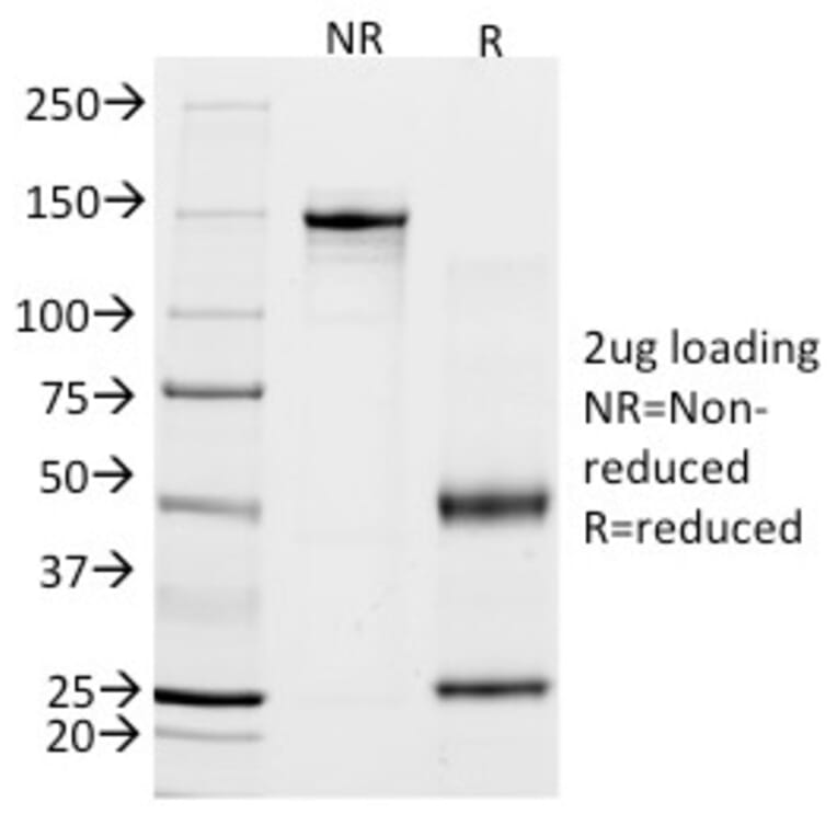 SDS-PAGE - Anti-Calponin 1 Antibody [CALP] (A248237) - Antibodies.com