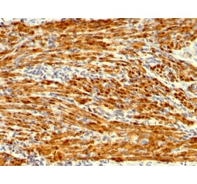 Immunohistochemistry - Anti-Calponin 1 Antibody [SPM169] (A248238) - Antibodies.com