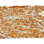 Immunohistochemistry - Anti-Calponin 1 Antibody [SPM169] (A248238) - Antibodies.com