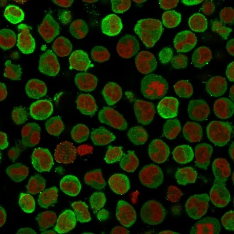 Immunofluorescence - Anti-Calponin 1 Antibody [SPM169] (A248238) - Antibodies.com