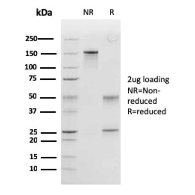 SDS-PAGE - Anti-Calponin 1 Antibody [SPM169] (A248238) - Antibodies.com