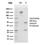 SDS-PAGE - Anti-Calponin 1 Antibody [SPM169] (A248238) - Antibodies.com