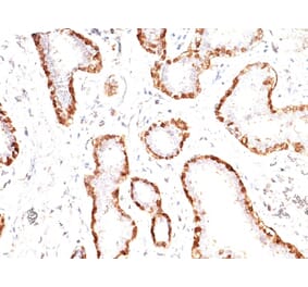 Immunohistochemistry - Anti-Calponin 1 Antibody [CNN1/832] (A248239) - Antibodies.com