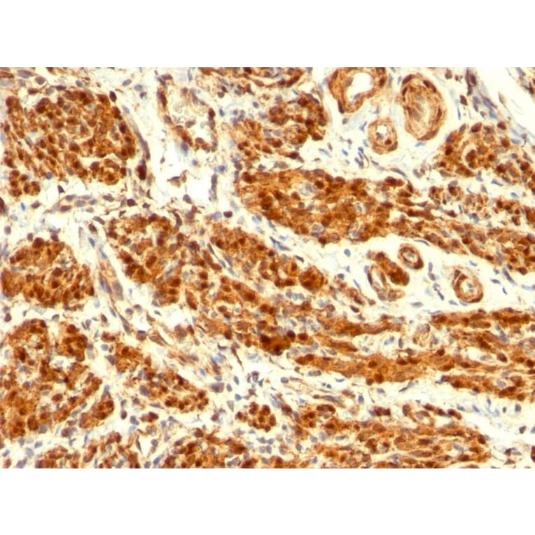 Immunohistochemistry - Anti-Calponin 1 Antibody [CNN1/832] (A248239) - Antibodies.com