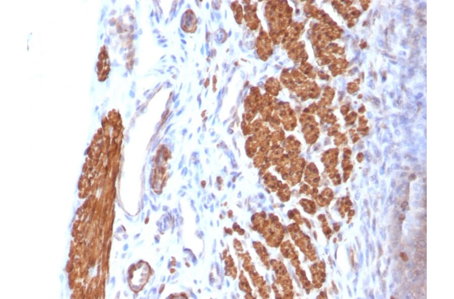 Immunohistochemistry - Anti-Calponin 1 Antibody [CNN1/832] (A248239) - Antibodies.com