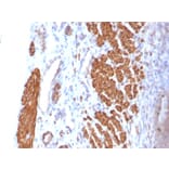 Immunohistochemistry - Anti-Calponin 1 Antibody [CNN1/832] (A248239) - Antibodies.com