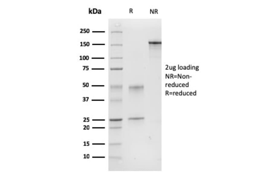 SDS-PAGE - Anti-Calponin 1 Antibody [CNN1/832] (A248239) - Antibodies.com