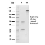 SDS-PAGE - Anti-Calponin 1 Antibody [CNN1/832] (A248239) - Antibodies.com