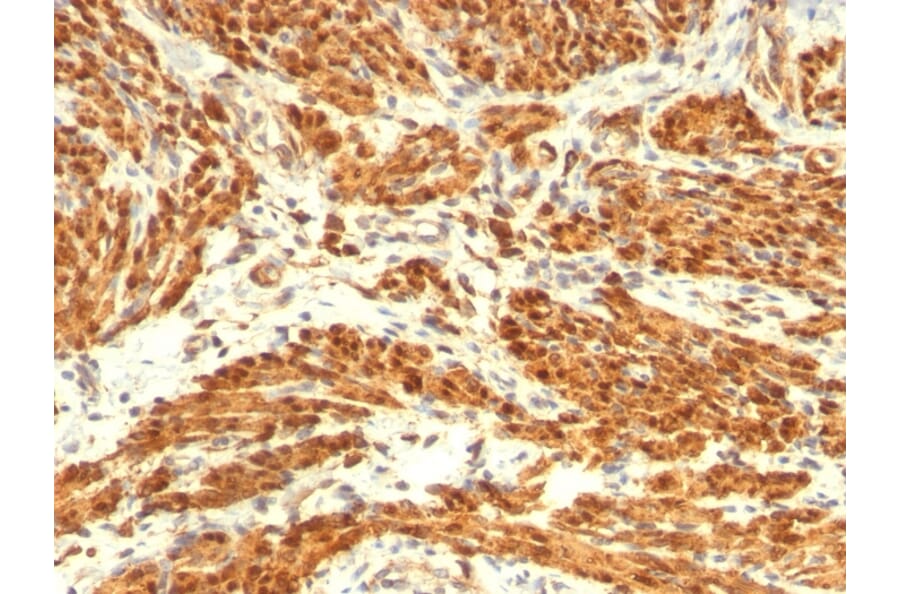 Immunohistochemistry - Anti-Calponin 1 Antibody [CNN1/832 + CALP] (A248240) - Antibodies.com