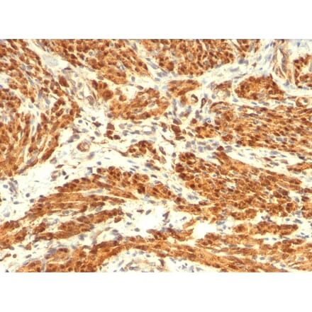 Immunohistochemistry - Anti-Calponin 1 Antibody [CNN1/832 + CALP] (A248240) - Antibodies.com