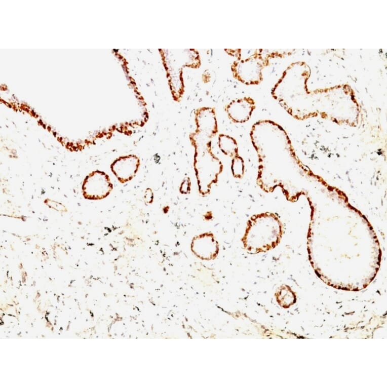 Immunohistochemistry - Anti-Calponin 1 Antibody [CNN1/832 + CALP] (A248240) - Antibodies.com