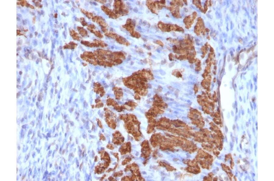 Immunohistochemistry - Anti-Calponin 1 Antibody [CNN1/832 + CALP] (A248240) - Antibodies.com