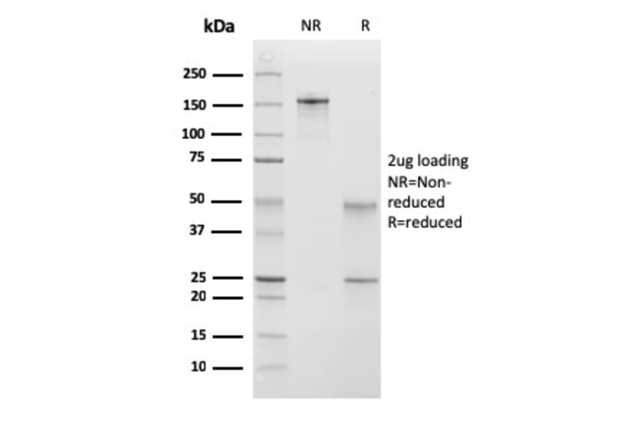 SDS-PAGE - Anti-Calponin 1 Antibody [CNN1/832 + CALP] (A248240) - Antibodies.com