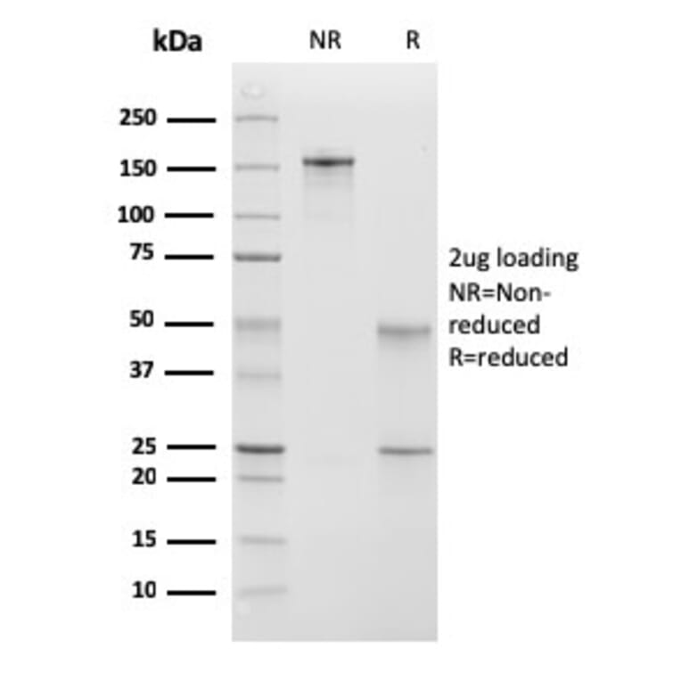 SDS-PAGE - Anti-Calponin 1 Antibody [CNN1/832 + CALP] (A248240) - Antibodies.com