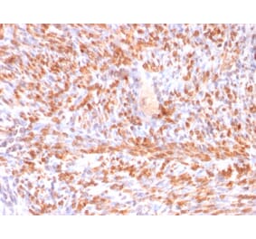 Immunohistochemistry - Anti-Calponin 1 Antibody [rCNN1/832] (A248241) - Antibodies.com