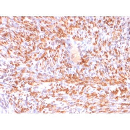 Immunohistochemistry - Anti-Calponin 1 Antibody [rCNN1/832] (A248241) - Antibodies.com