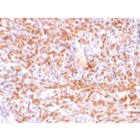Immunohistochemistry - Anti-Calponin 1 Antibody [rCNN1/832] (A248241) - Antibodies.com