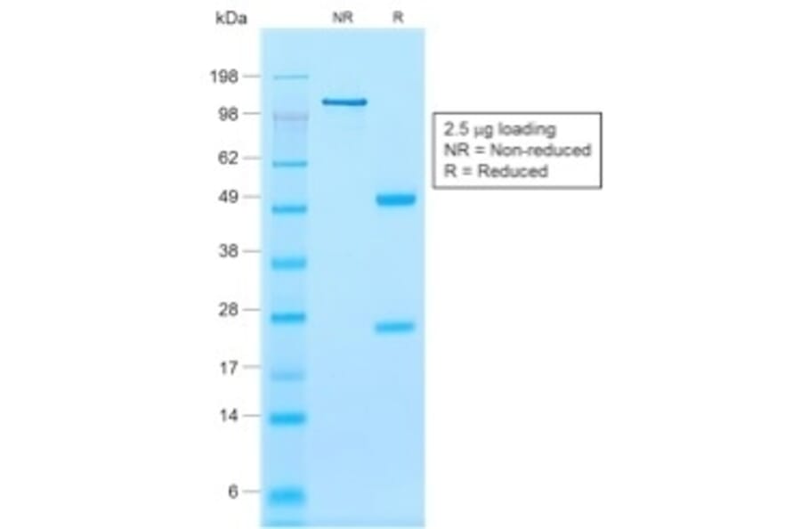 SDS-PAGE - Anti-Calponin 1 Antibody [rCNN1/832] (A248241) - Antibodies.com