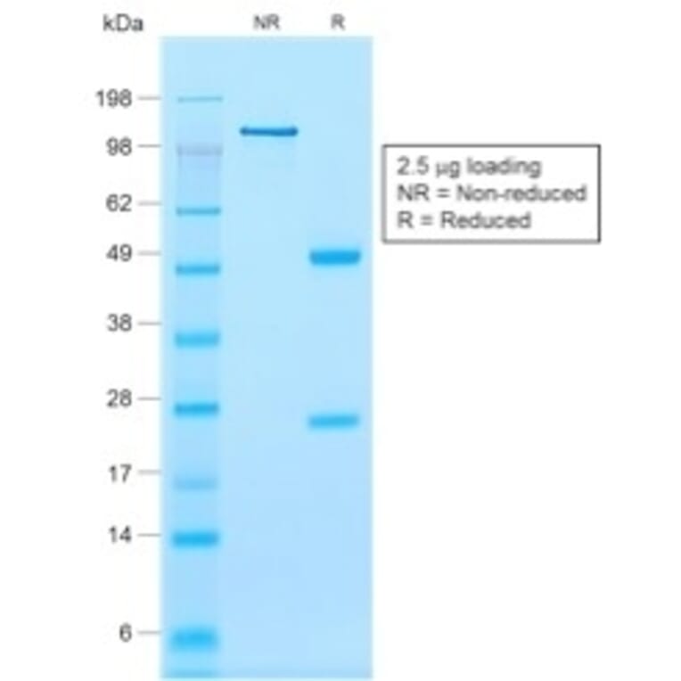 SDS-PAGE - Anti-Calponin 1 Antibody [rCNN1/832] (A248241) - Antibodies.com