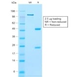 SDS-PAGE - Anti-Calponin 1 Antibody [rCNN1/832] (A248241) - Antibodies.com