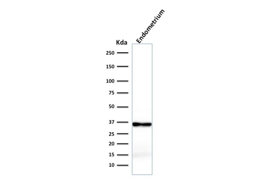Western Blot - Anti-Calponin 1 Antibody [rCNN1/832] (A248241) - Antibodies.com