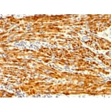 Immunohistochemistry - Anti-Calponin 1 Antibody [CNN1/1408R] (A248242) - Antibodies.com
