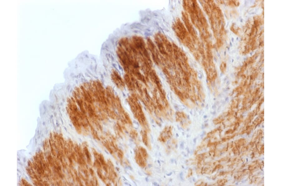 Immunohistochemistry - Anti-Calponin 1 Antibody [CNN1/1408R] (A248242) - Antibodies.com